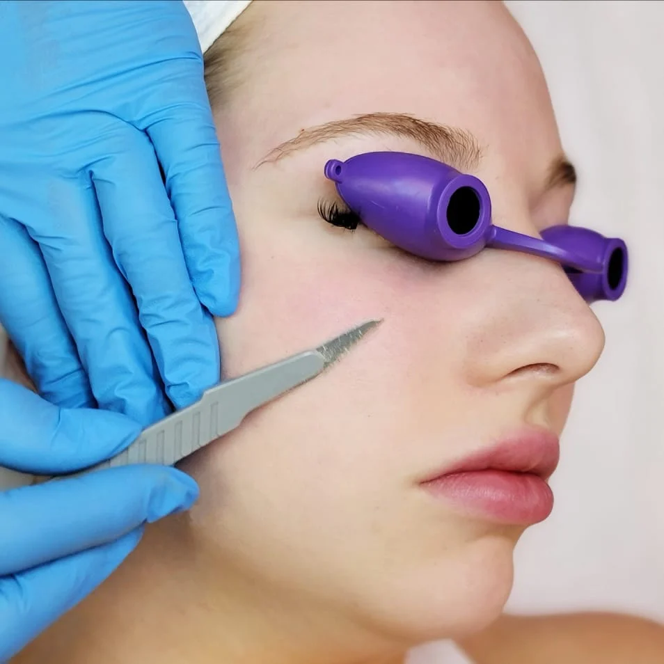 Dermaplaning with Facial Enzyme